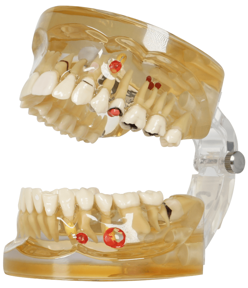 TIPODONTO TRANSP 32PZ C/PROCESOS IN