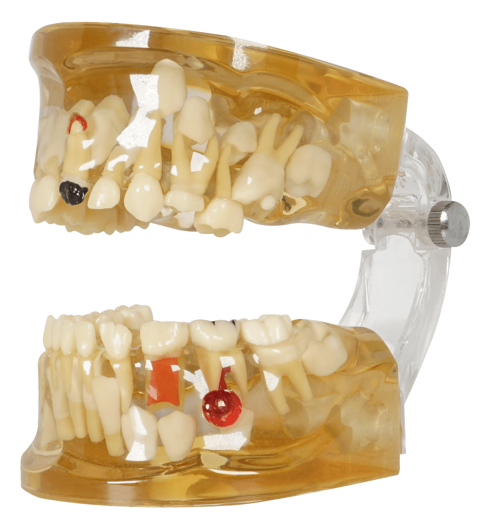 MODELO TRANSP INF C/PROCESOS INFECC