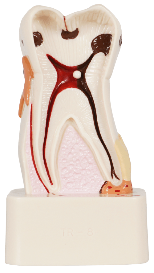 MOLAR C/CORTE SAGITAL