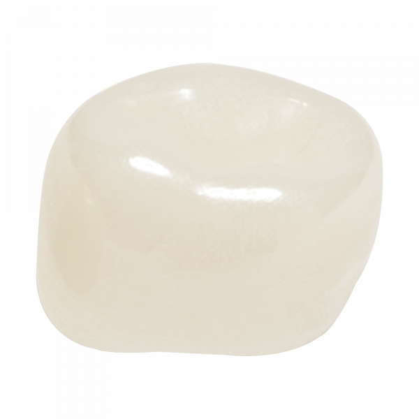 Coronas de zirconia Nusmile – 1er. molar angosto inferior derecho