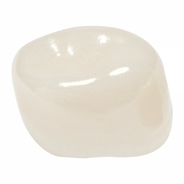 Coronas de zirconia Nusmile – 1er molar superior derecho