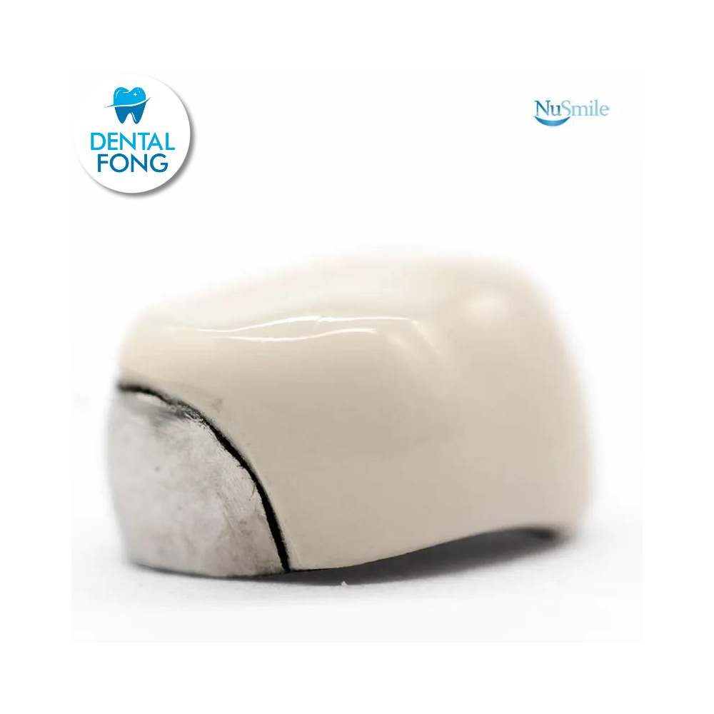 CORONA FRENTE ESTETICO INF-DER 1er. MOLAR TEMPORAL #2 CLARO (DLR2106L)