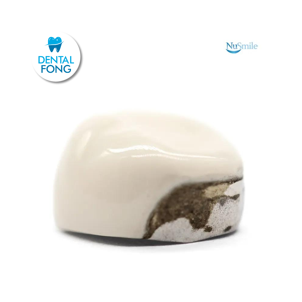 CORONA FRENTE ESTETICO INF-IZQ 1er. MOLAR TEMPORAL #3 CLARO (DLL3106L)