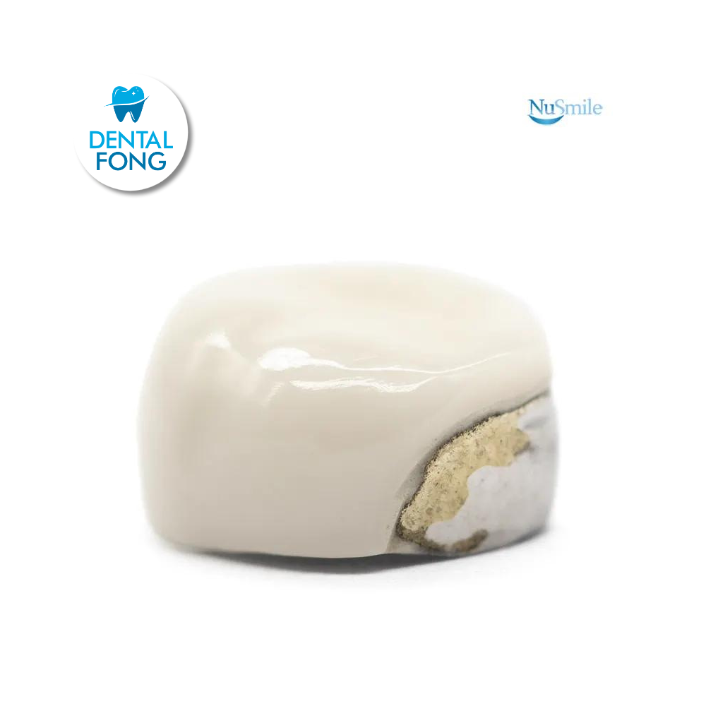 CORONA FRENTE ESTETICO INF-IZQ 1er. MOLAR TEMPORAL #6 CLARO (DLL6106L)