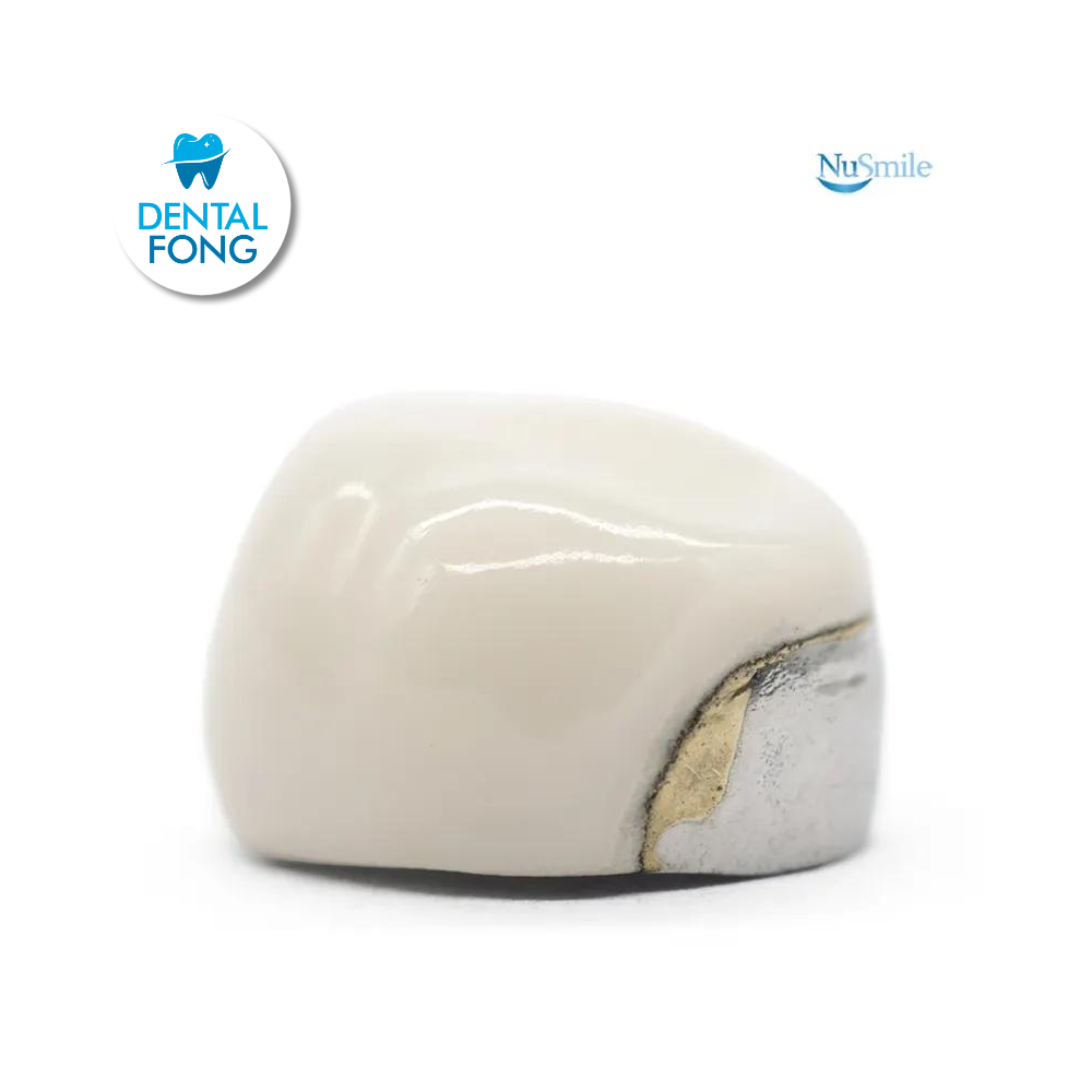 CORONA FRENTE ESTETICO INF-IZQ 1er. MOLAR TEMPORAL #7 CLARO (DLL7106L)