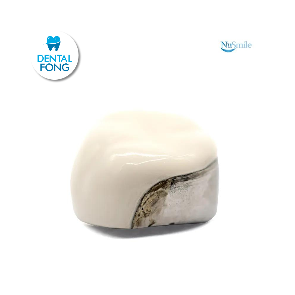 CORONA FRENTE ESTETICO INF-IZQ 2do. MOLAR TEMPORAL #7 CLARO (ELL7106L)