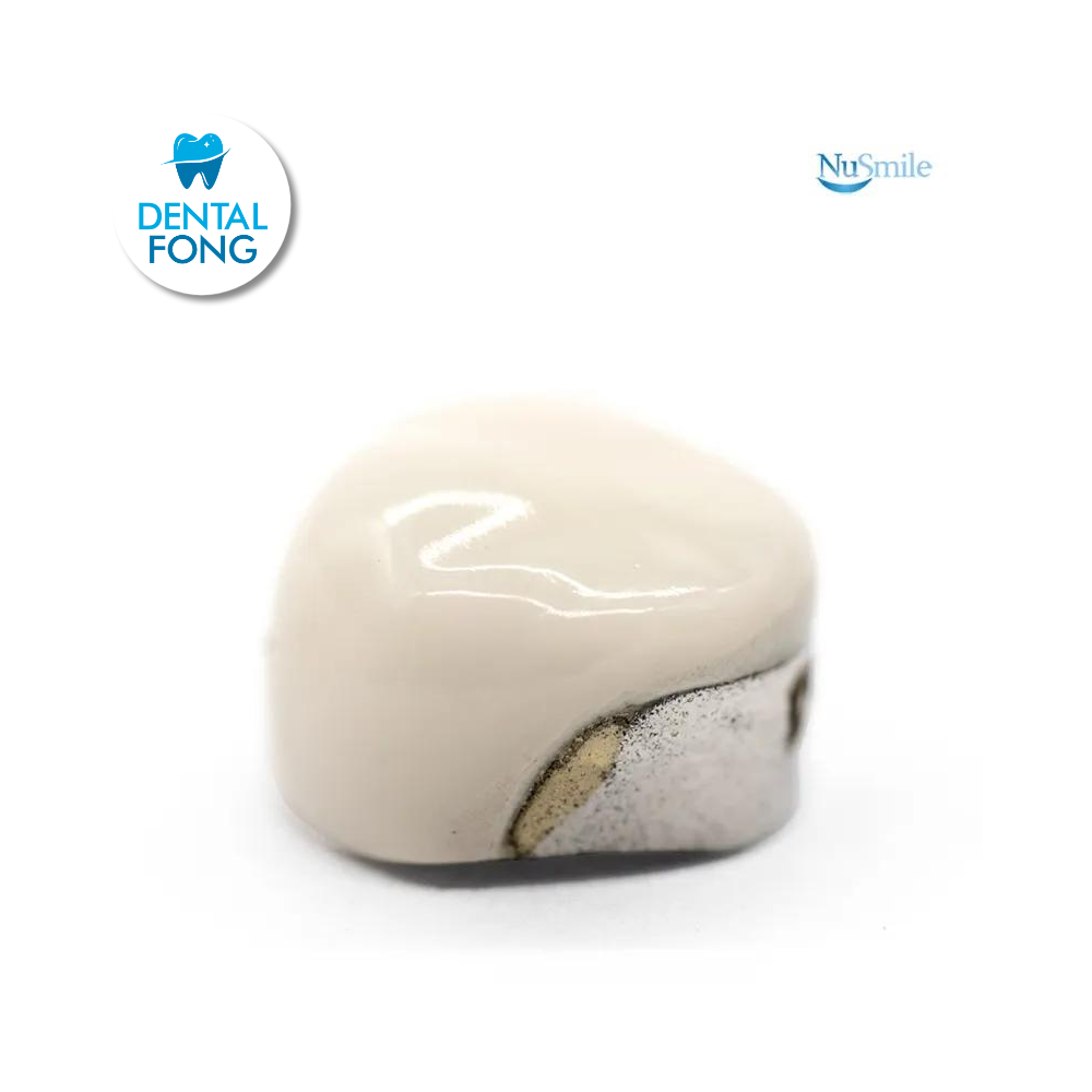 CORONA FRENTE ESTETICO SUP-DER 1er. MOLAR TEMPORAL #1 CLARO (DUR1106L)