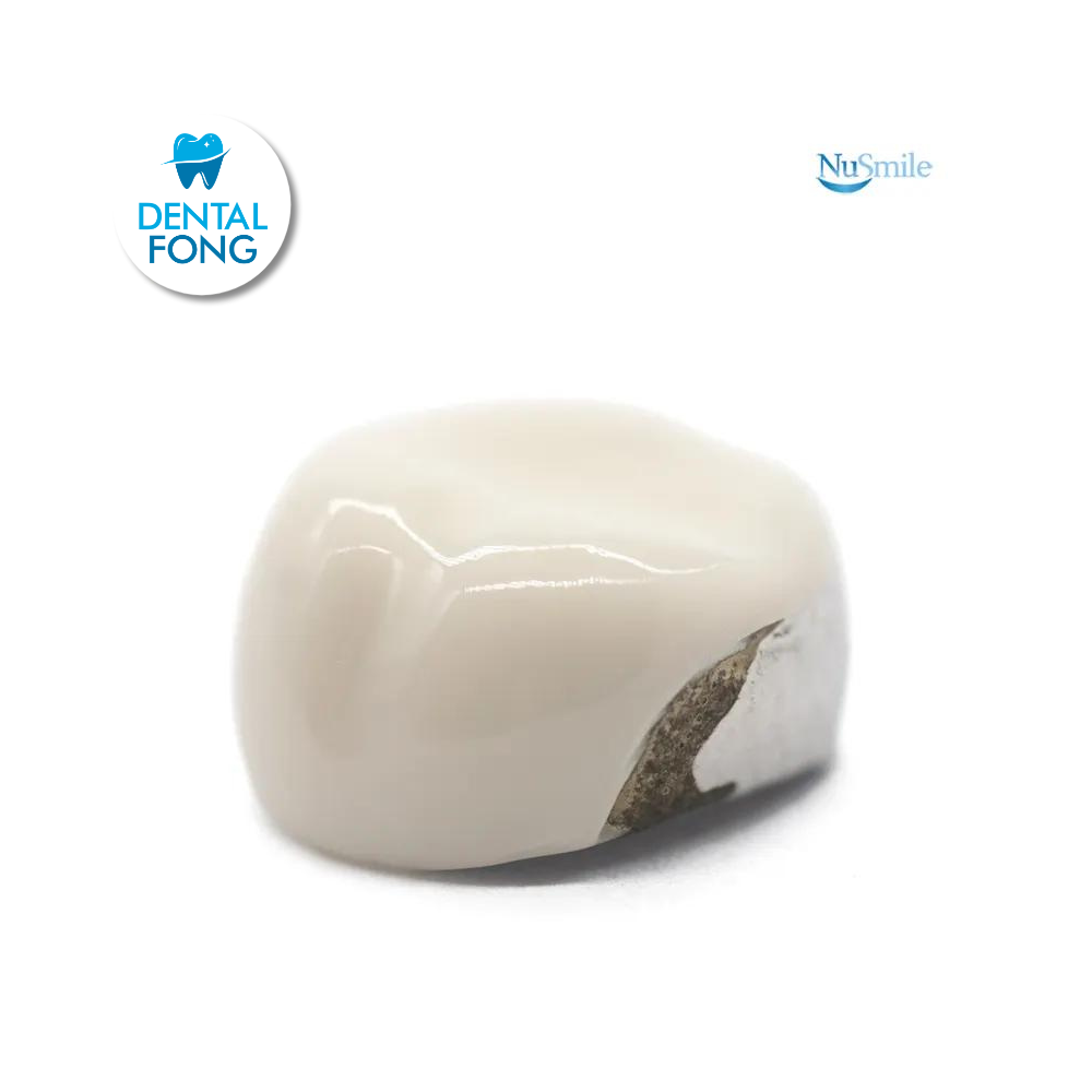 CORONA FRENTE ESTETICO SUP-DER 2do. MOLAR TEMPORAL #4 CLARO (EUR4106L)