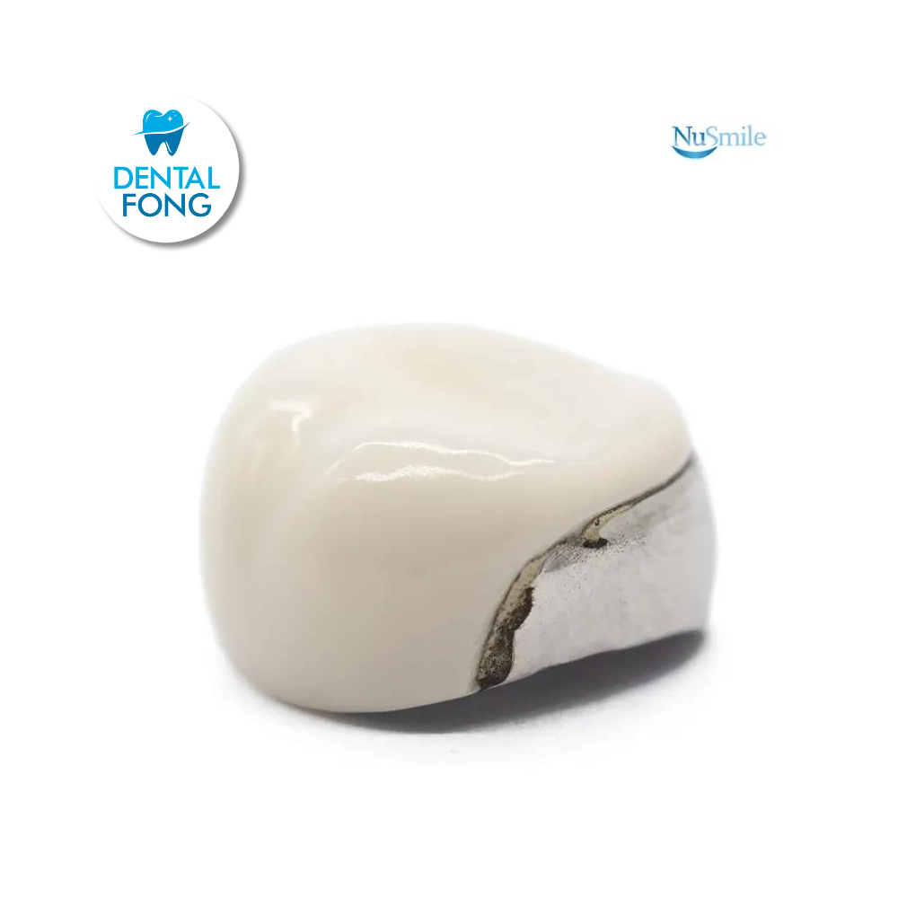 CORONA FRENTE ESTETICO SUP-DER 2do. MOLAR TEMPORAL #5 CLARO (EUR5106L)