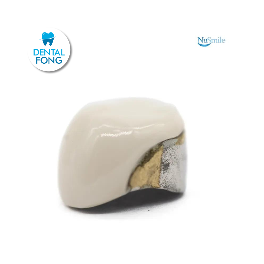 CORONA FRENTE ESTETICO SUP-IZQ 1er. MOLAR TEMPORAL #1 CLARO (DUL1106L)