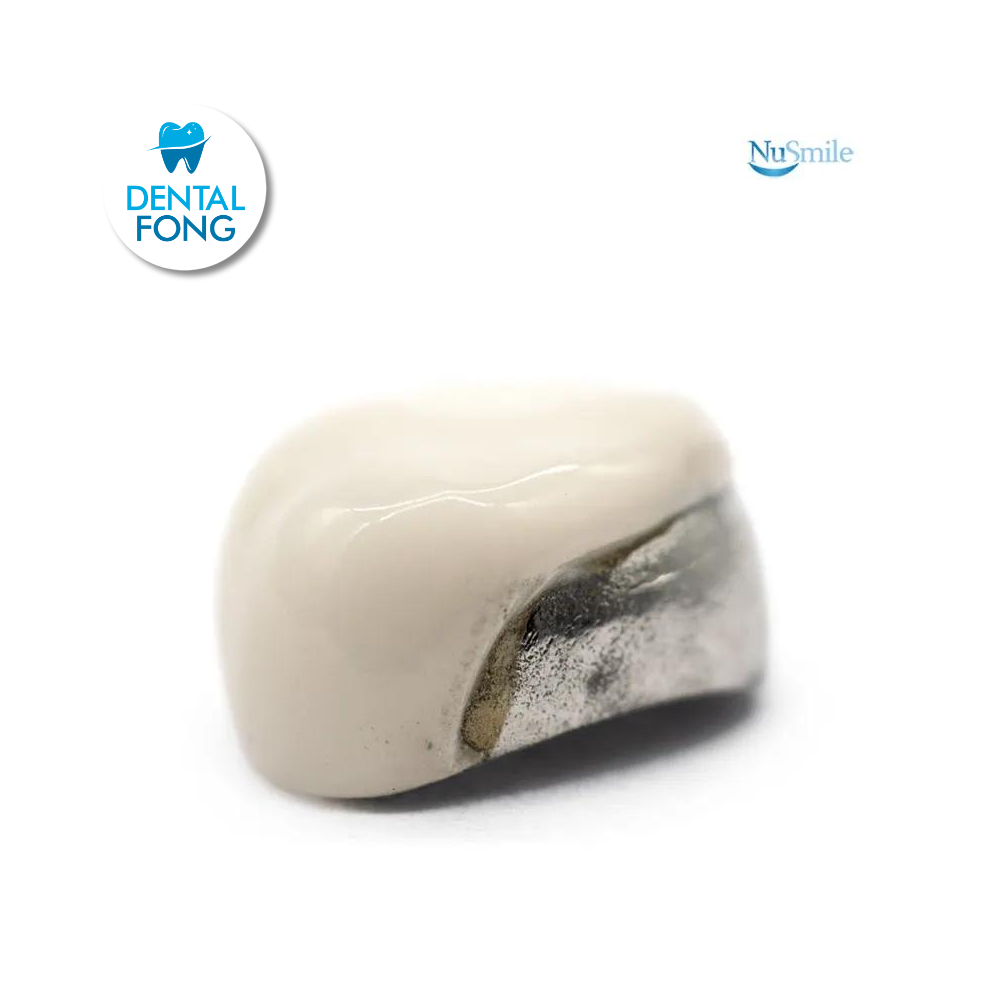 CORONA FRENTE ESTETICO SUP-IZQ 1er. MOLAR TEMPORAL #3 CLARO (DUL3106L)