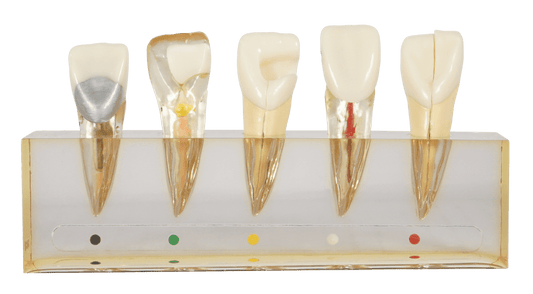 MODELO C/5 ETAPAS DE ENDODONCIA