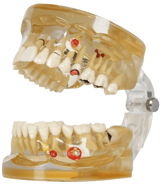 TIPODONTO TRANSP 32PZ C/PROCESOS IN