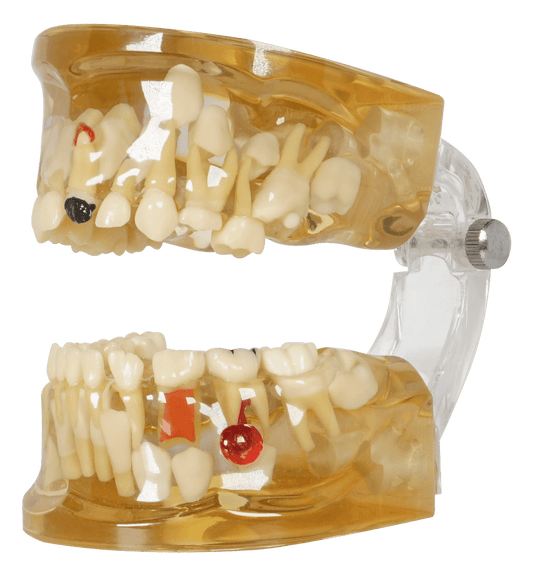 MODELO TRANSP INF C/PROCESOS INFECC