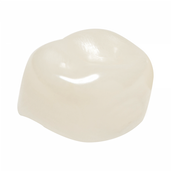 Molar inferior izquierdo Nusmile- 1er. molar coronas de zirconia