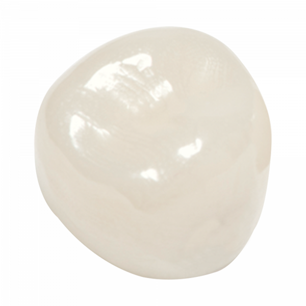 Coronas de zirconia Nusmile – 1er molar superior izquierdo