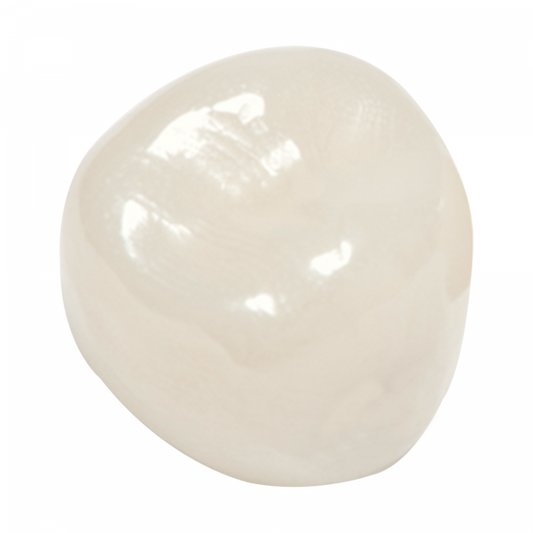 Coronas de zirconia Nusmile – 1er molar superior izquierdo