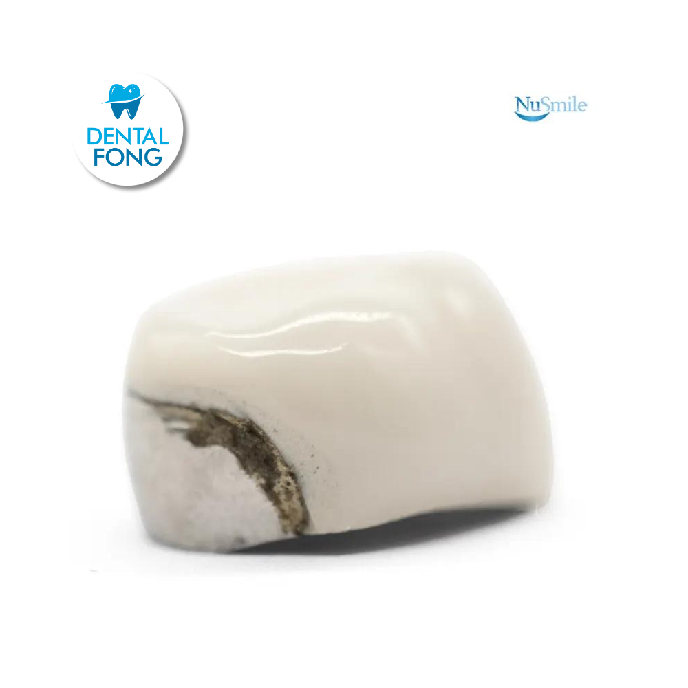 CORONA FRENTE ESTETICO INF-DER 1er. MOLAR TEMPORAL #5 CLARO (DLR5106L)