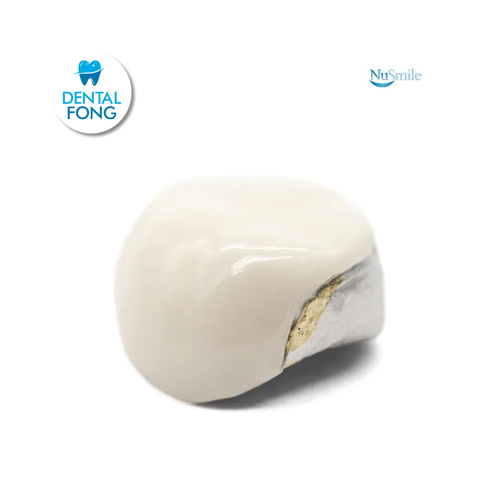 CORONA FRENTE ESTETICO INF-DER 2do. MOLAR TEMPORAL #2 CLARO (ELR2106L)