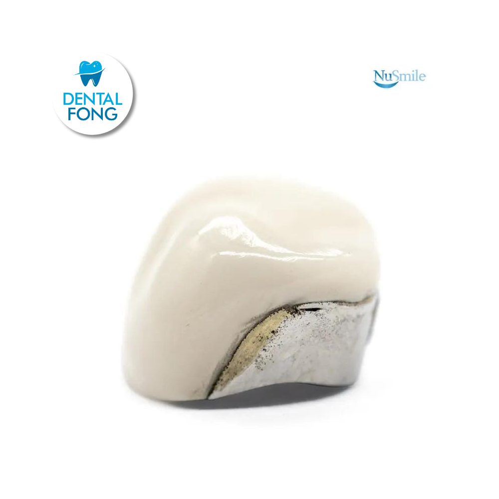 CORONA FRENTE ESTETICO INF-IZQ 1er. MOLAR TEMPORAL #1 CLARO (DLL1106L)