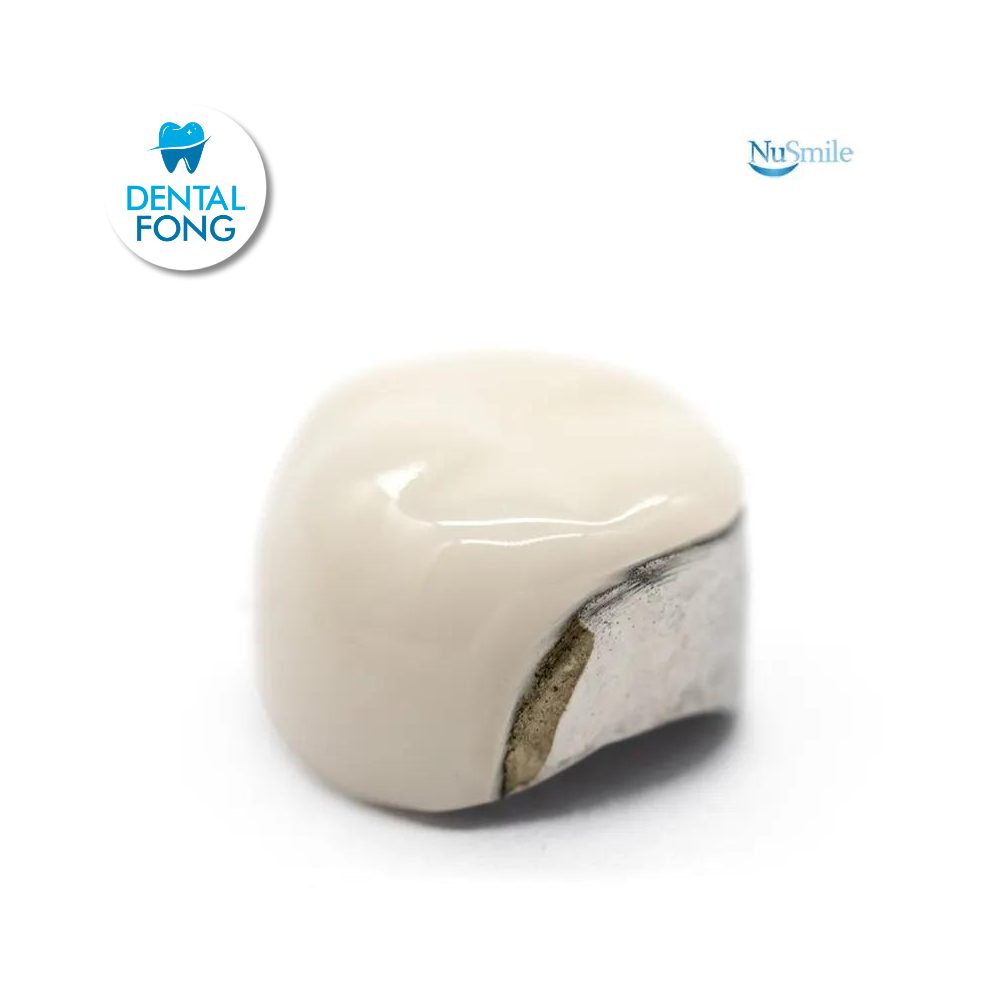 CORONA FRENTE ESTETICO INF-IZQ 2do. MOLAR TEMPORAL #1 CLARO (ELL1106L)