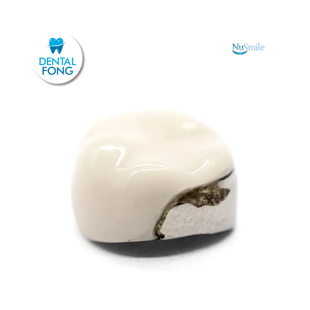 CORONA FRENTE ESTETICO INF-IZQ 2do. MOLAR TEMPORAL #2 CLARO (ELL2106L)