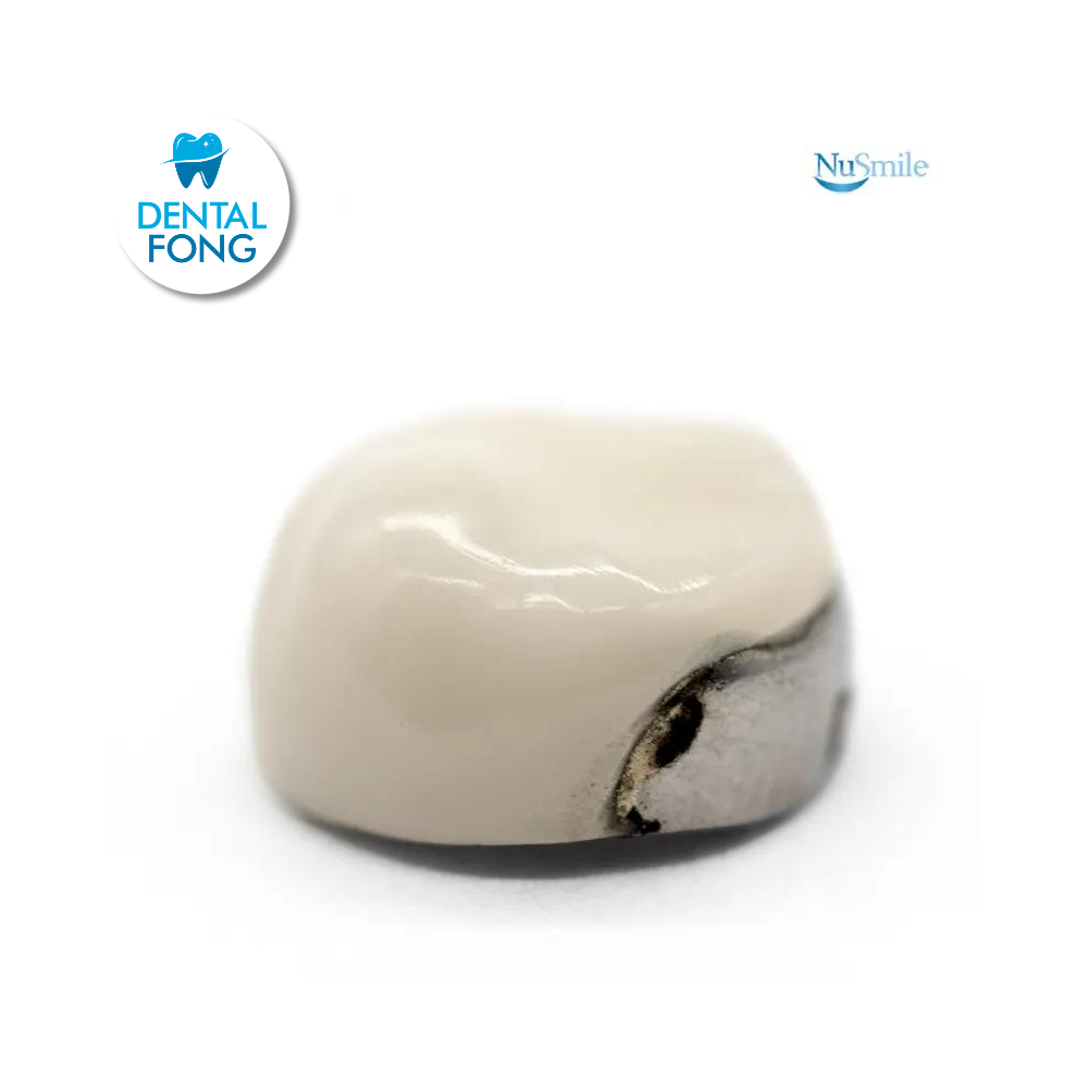 CORONA FRENTE ESTETICO SUP-DER 1er. MOLAR TEMPORAL #2 CLARO (DUR2106L)