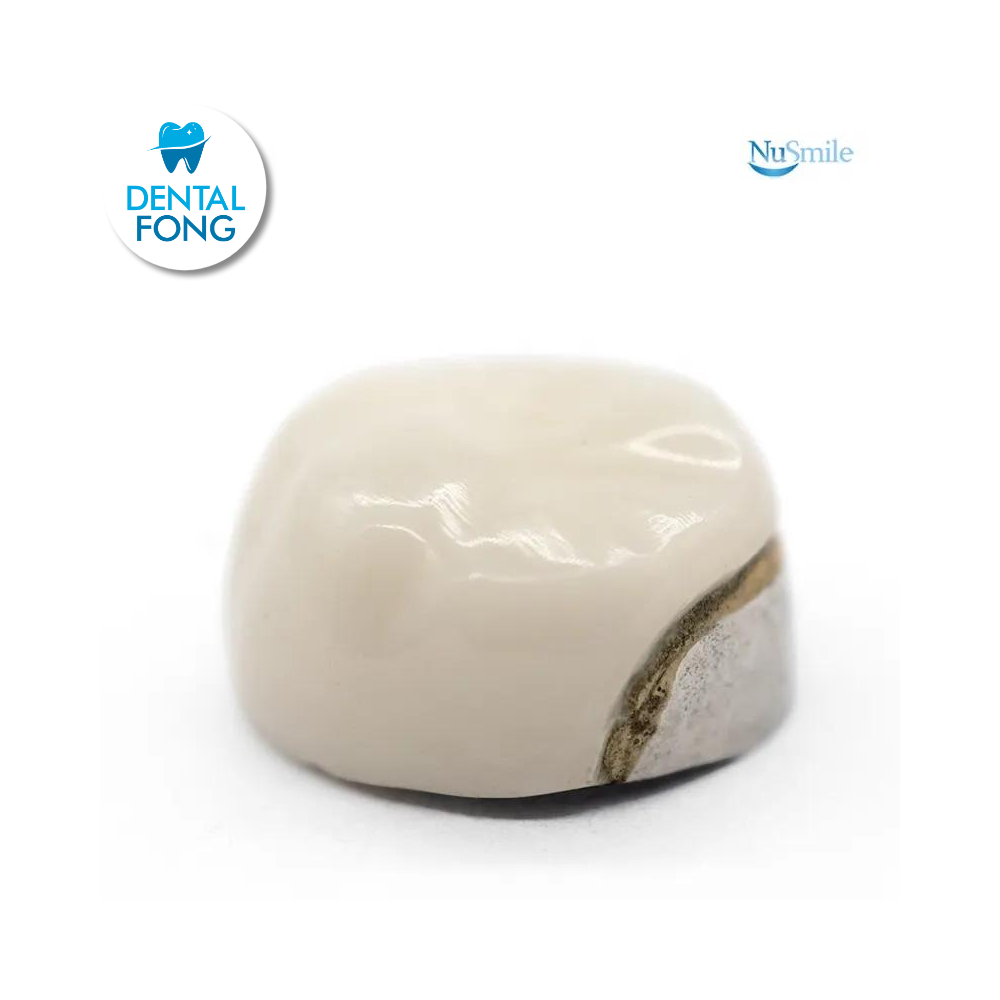 CORONA FRENTE ESTETICO SUP-DER 1er. MOLAR TEMPORAL #5 CLARO (DUR5106L)