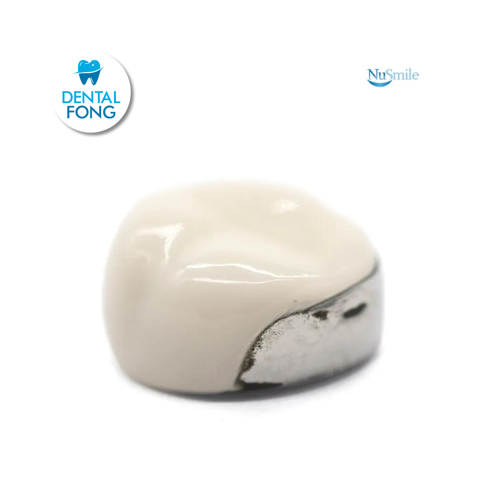 CORONA FRENTE ESTETICO SUP-DER 1er. MOLAR TEMPORAL #3 CLARO (DUR3106L)