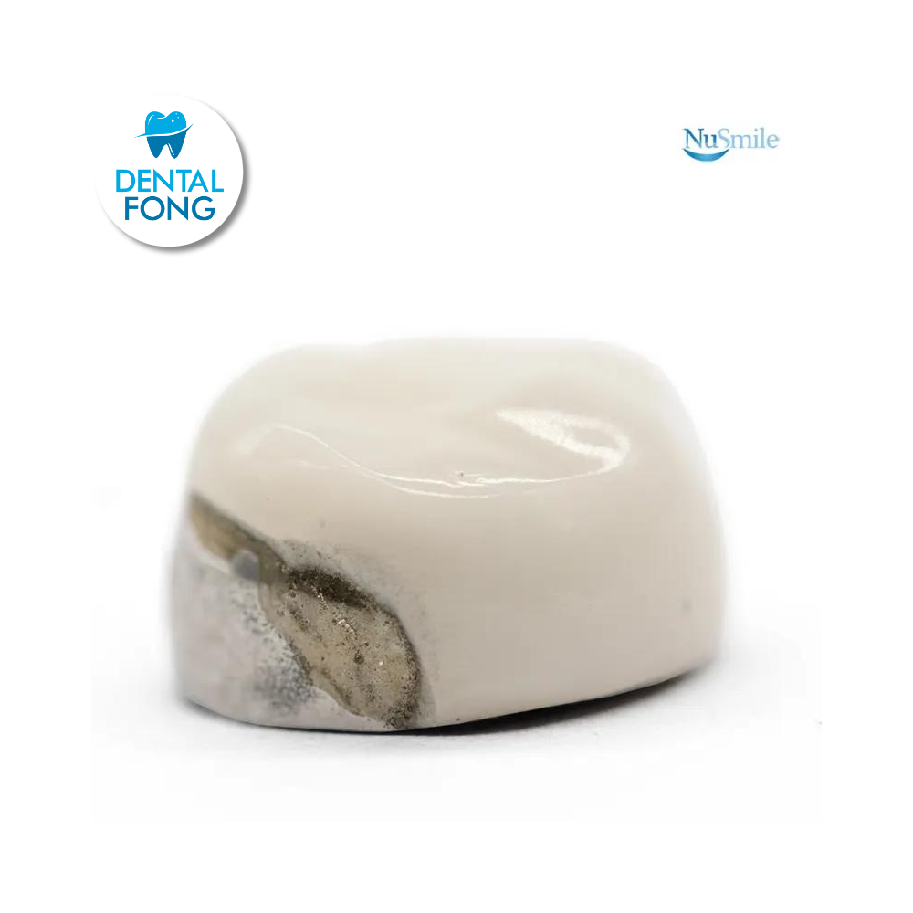 CORONA FRENTE ESTETICO SUP-IZQ 1er. MOLAR TEMPORAL #2 CLARO (DUL2106L)