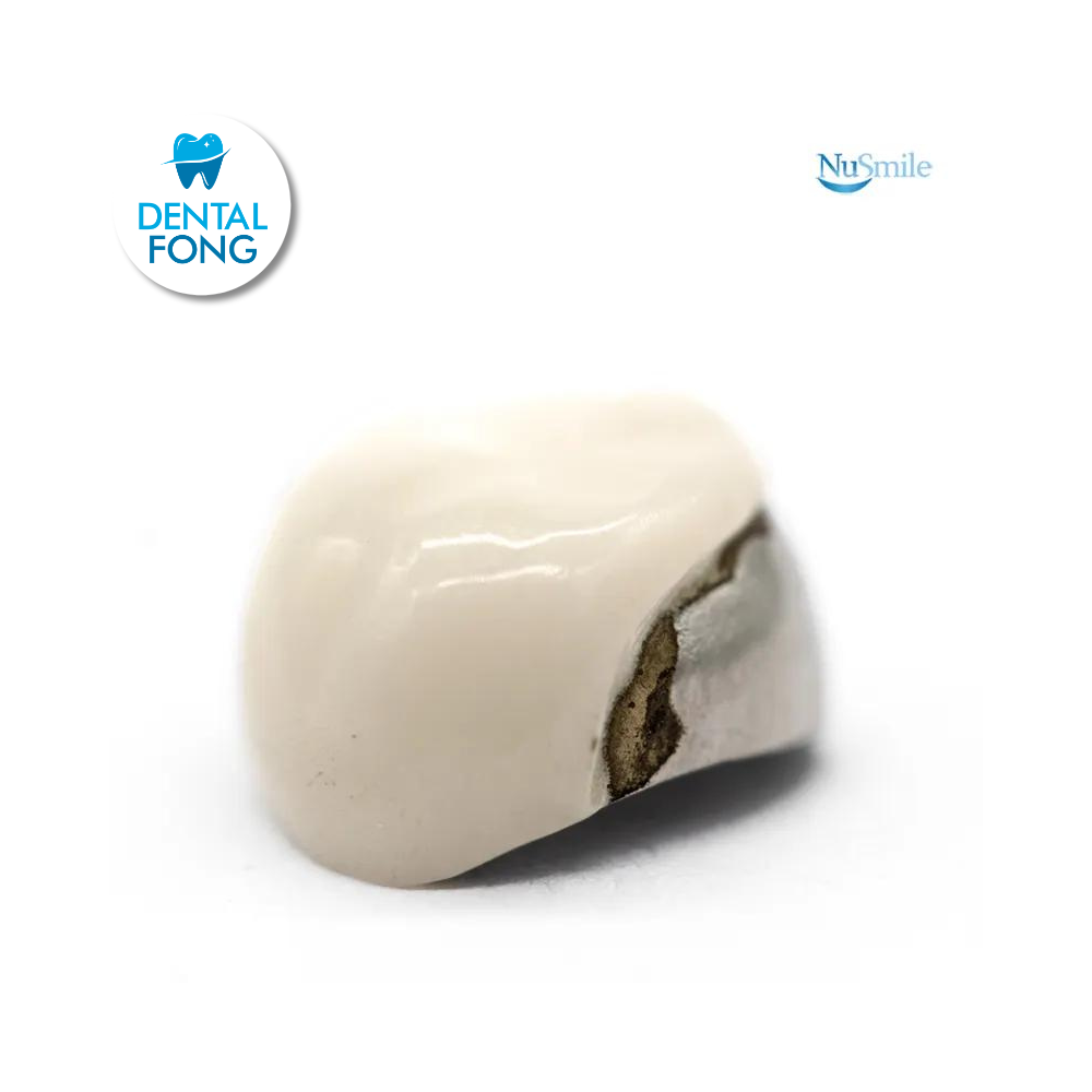 CORONA FRENTE ESTETICO SUP-IZQ 1er. MOLAR TEMPORAL #4 CLARO (DUL4106L)