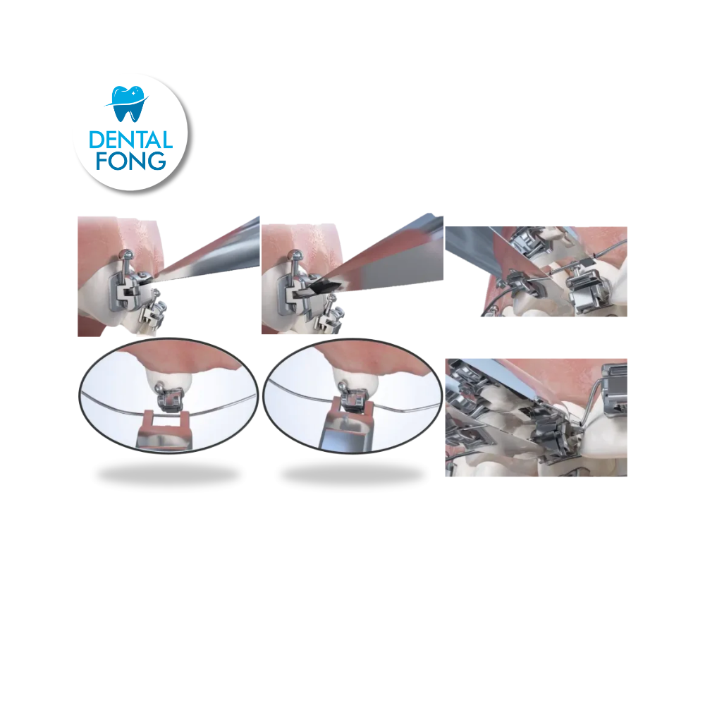 Herramienta de Apertura y Cierre Angelus Smart SL