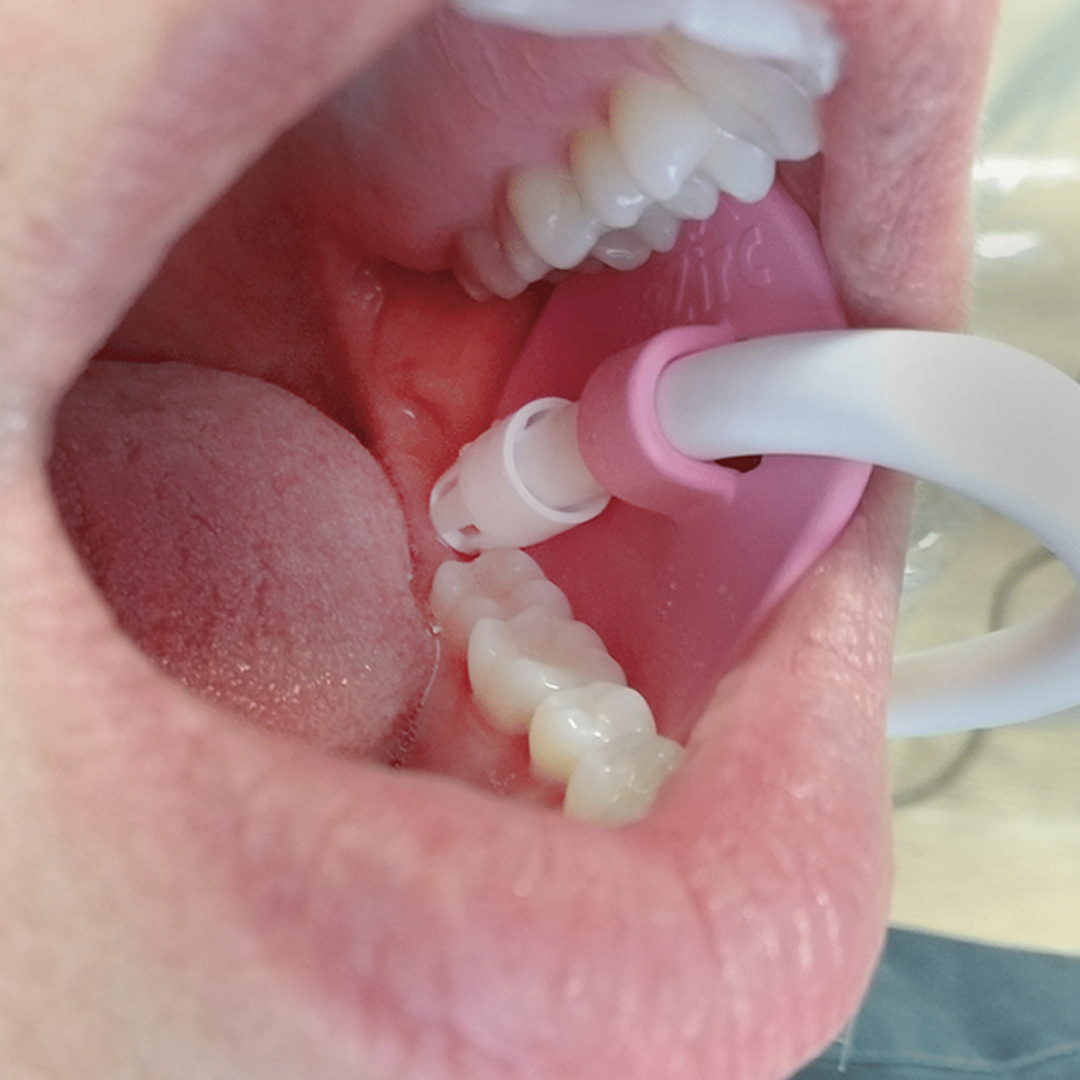 PINK PETAL – AUXILIAR PARA EYECTORES DESECHABLES C/50PZS.