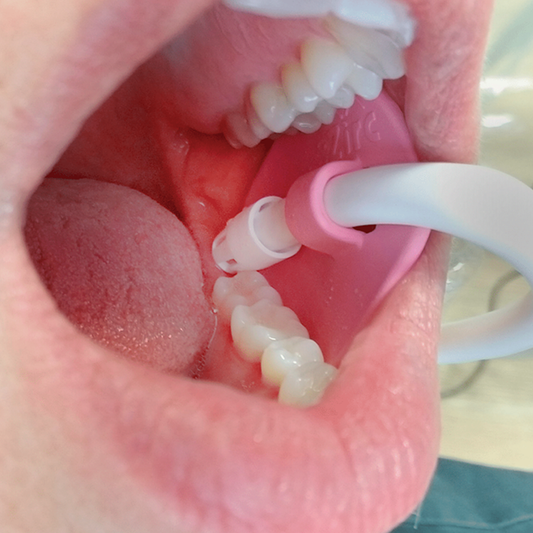 PINK PETAL – AUXILIAR PARA EYECTORES DESECHABLES C/50PZS.