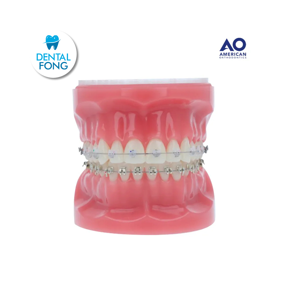 P/E TIPODONTO CON BRACKET ARCADA SUPERIOR CLEAR-INFERIOR EMP