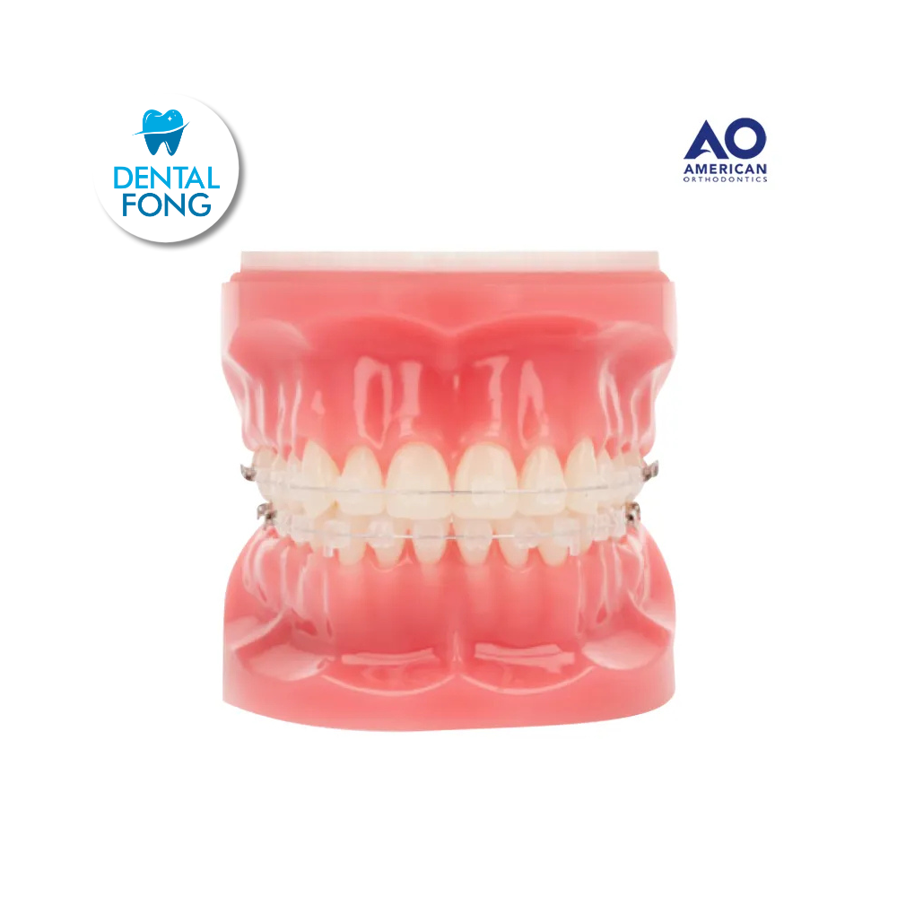 P/E TIPODONTO CON BRACKET ARCADA SUPERIOR RADIANCE-INFERIOR