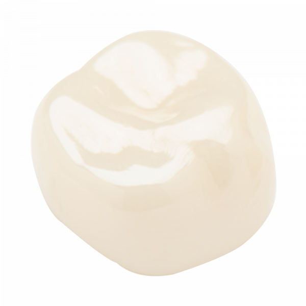 Coronas de zirconia Nusmile -1er. molar permanente superior izquierdo tono A2