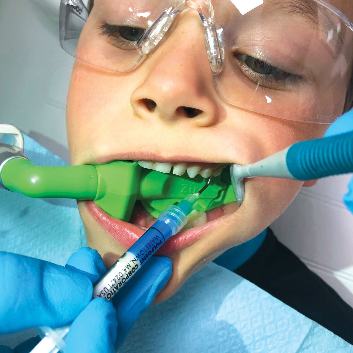 EYECTOR, RETENEDOR Y ABRE BOCAS MR. THIRSTY